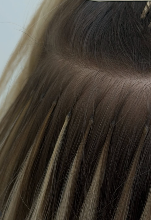 extensions -mallion-ano-liosia