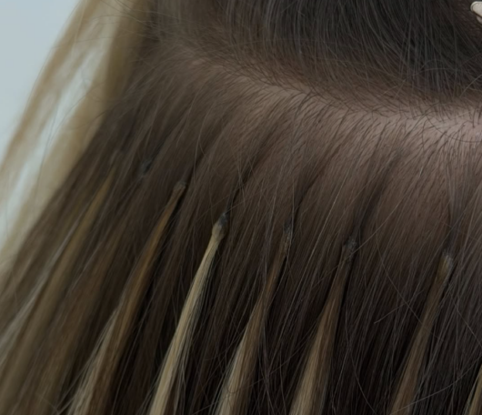 extensions -mallion-ano-liosia