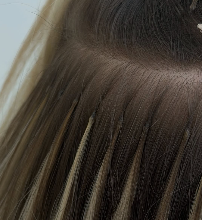 extensions -mallion-ano-liosia